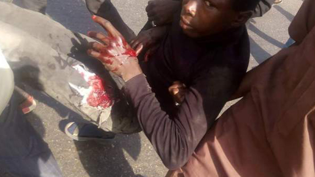 nigeria-ashoura-wounded